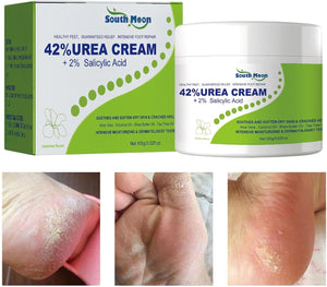 South Moon Urea Cream كريم اليوريا وحمض الساليسيليك من ساوث مون