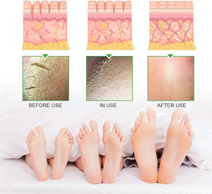 South Moon Urea Cream كريم اليوريا وحمض الساليسيليك من ساوث مون